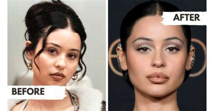 Alexa Demie before and after surgery ·