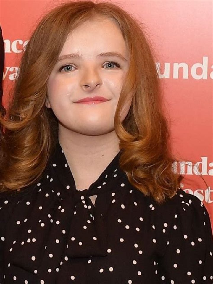 Does Milly Shapiro Have Down Syndrome? Face Condition
