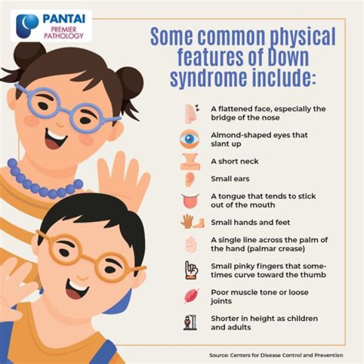 Lily Mae Down Syndrome: Health Update 2023