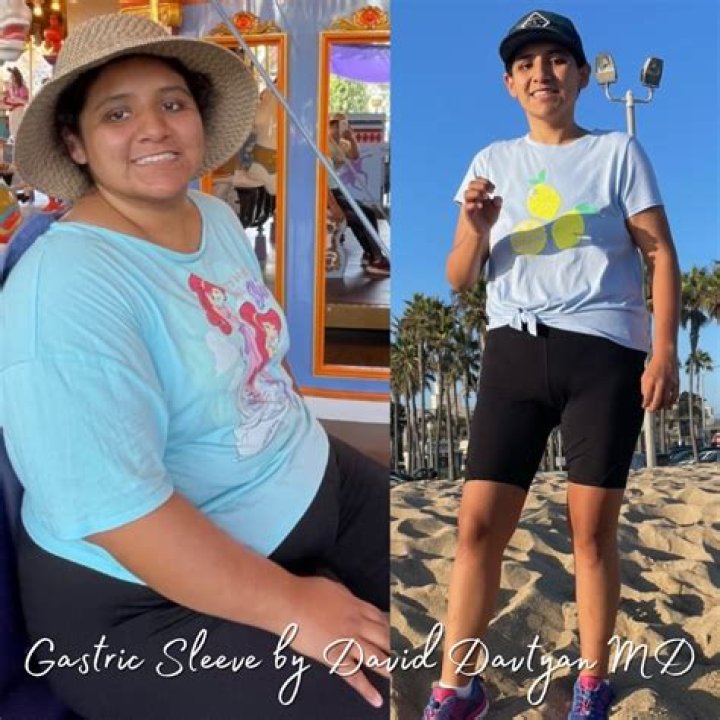 Muni Long Weight Loss Journey, Plastic Surgery Before And After Photos