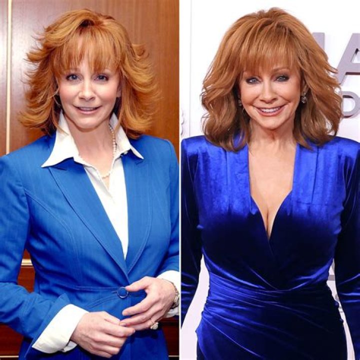 Reba Mcentire Plastic Surgery: Before And After Photo