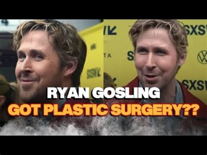 Ryan Gosling Plastic Surgery: Surprising Revelations Unveiled