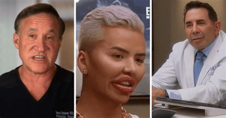 Who is Viraljen TikTok? Jen Blanco Before Surgery, Age Instagram